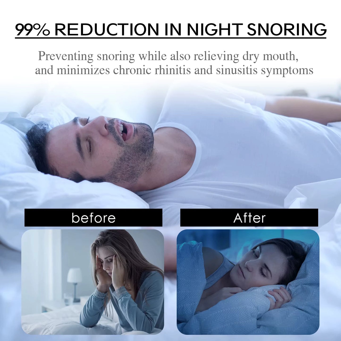 Anti Snoring Mouth Tape (30 Day Supply)