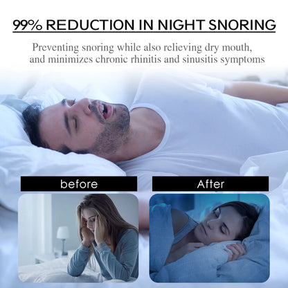 Anti Snoring Mouth Tape (30 Day Supply)